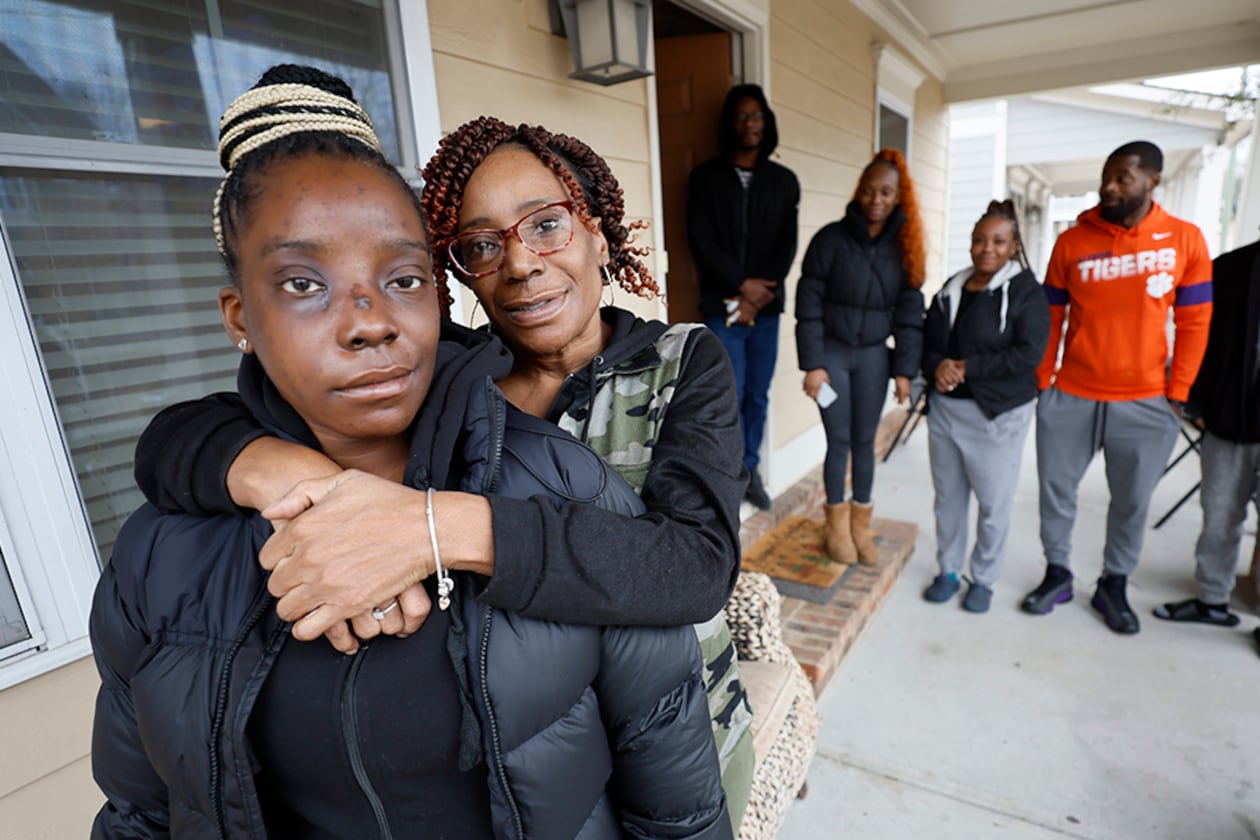 Tonya McElrathbey embraces her daughter Brianna McElrathbey outside her house during a family reunion as the other siblings pose in the background. Tonya’s family has always been together, but their bond grows stronger after Brianna’s incident when she was shot on January 2, 2024.
Miguel Martinez /miguel.martinezjimenez@ajc.com
