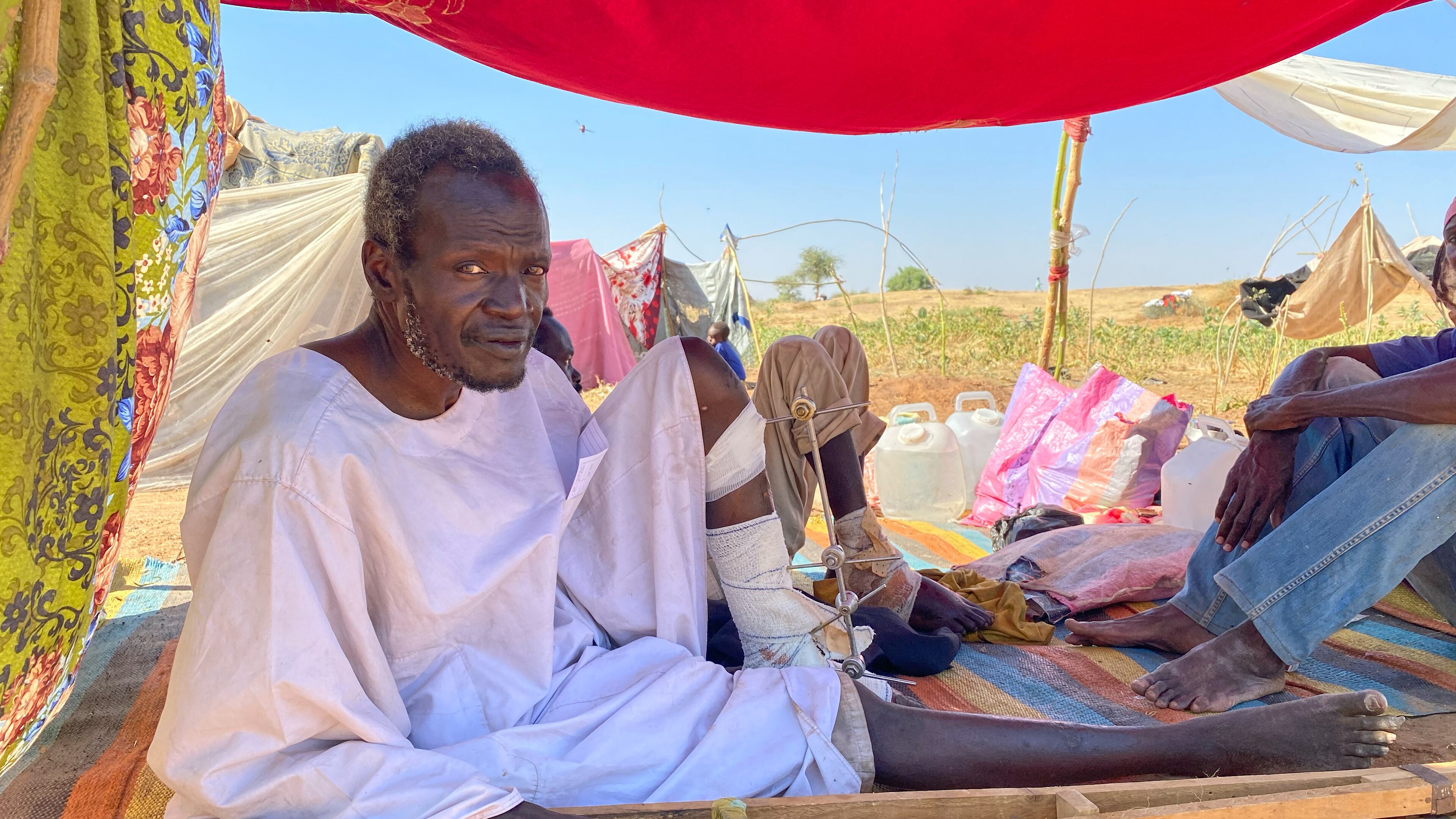 Adam Mohammed Adem, an injured Sudanese who fled el-Fasher city, after Sudan's paramilitary forces killed hundreds of people in the western Darfur region, receives medical care at a camp in Tawila, Sudan, Thursday, Oct. 30, 2025. (AP Photo/Mohammed Abaker)