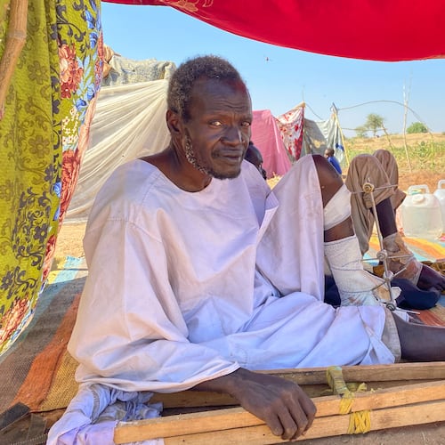 Adam Mohammed Adem, an injured Sudanese who fled el-Fasher city, after Sudan's paramilitary forces killed hundreds of people in the western Darfur region, receives medical care at a camp in Tawila, Sudan, Thursday, Oct. 30, 2025. (AP Photo/Mohammed Abaker)