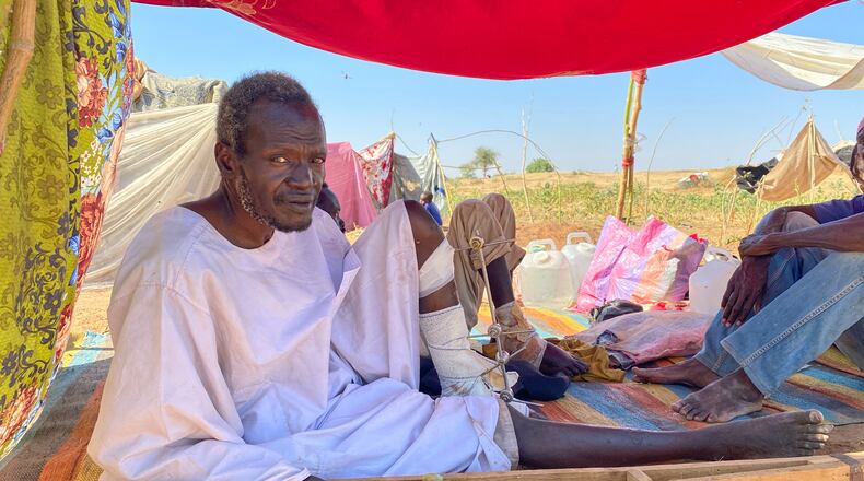 Adam Mohammed Adem, an injured Sudanese who fled el-Fasher city, after Sudan's paramilitary forces killed hundreds of people in the western Darfur region, receives medical care at a camp in Tawila, Sudan, Thursday, Oct. 30, 2025. (AP Photo/Mohammed Abaker)