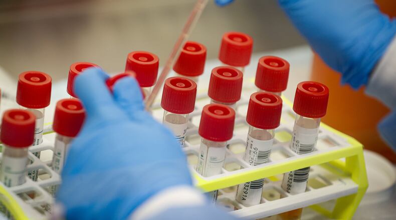 FILE - In this Wednesday, March 11, 2020 file photo, a technician prepares COVID-19 coronavirus patient samples for testing at a laboratory in New York’s Long Island. Wide scale testing is a critical part of tracking and containing infectious diseases. But the U.S. effort has been plagued by a series of missteps, including accuracy problems with the test kits the CDC sent to other labs and bureaucratic hurdles that slowed the entrance of large, private sector labs. (AP Photo/John Minchillo)