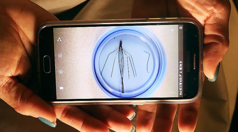 Sherr-una (Sheri) Booker shows a photo on her cell phone of the debris removed from her body.