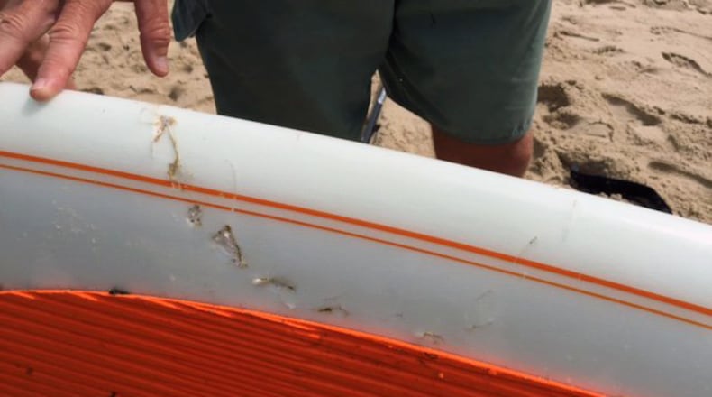 Authorities in Massachusetts closed down a beach on the Cape Code National Shoreline after a paddleboard was bit by a shark.