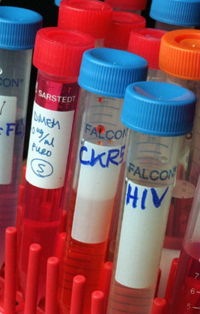 An HIV/AIDS timeline