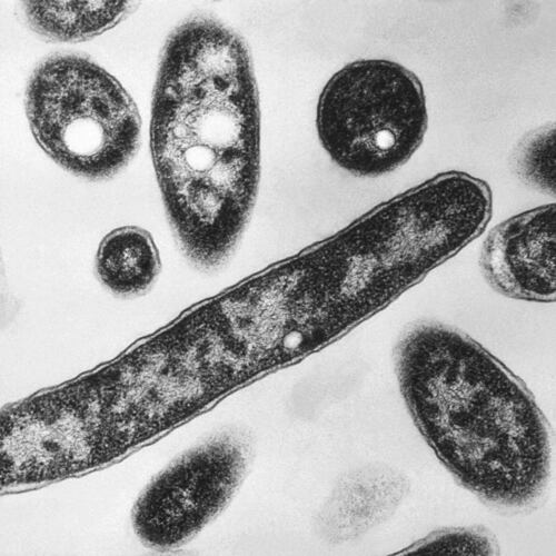 FILE - This 1978 electron microscope image made available by the Centers for Disease Control and Prevention shows Legionella pneumophila bacteria which are responsible for causing the pneumonic disease Legionnaires' disease. (Francis Chandler/CDC via AP, File)