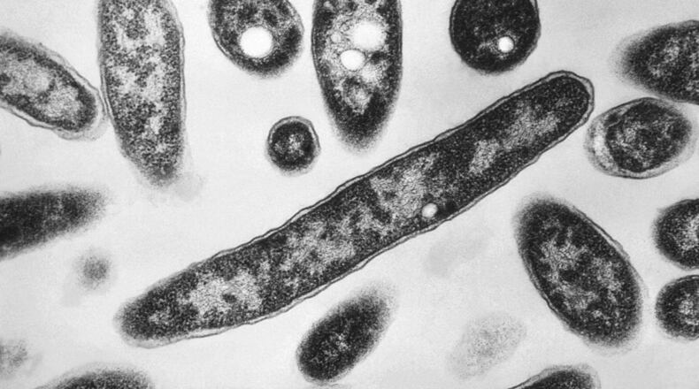 FILE - This 1978 electron microscope image made available by the Centers for Disease Control and Prevention shows Legionella pneumophila bacteria which are responsible for causing the pneumonic disease Legionnaires' disease. (Francis Chandler/CDC via AP, File)