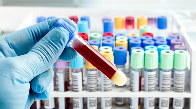 Signs and symptoms of sickle cell anemia usually appear around 5 months of age, and they vary from person to person and change over time. Signs and symptoms can include anemia, episodes of pain, swelling of the hands and feet, frequent infections, delayed grown or puberty, and vision problems. (Dreamstime/TNS)