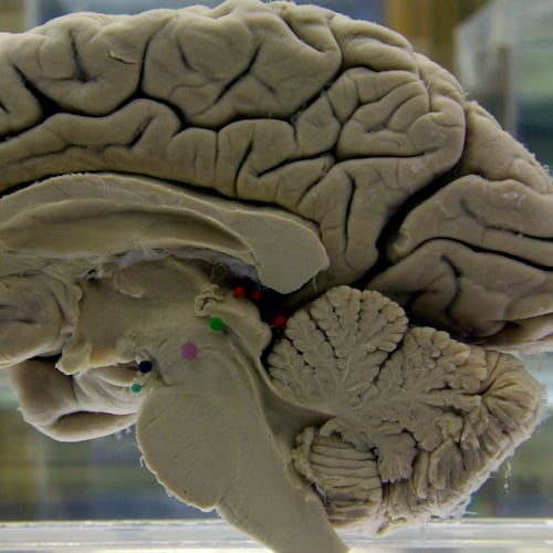 FILE - A section of a preserved human brain on display at the Museum of Neuroanatomy at the University at Buffalo, in Buffalo, N.Y., on Tuesday, Oct. 7, 2003. (AP Photo/David Duprey, File)