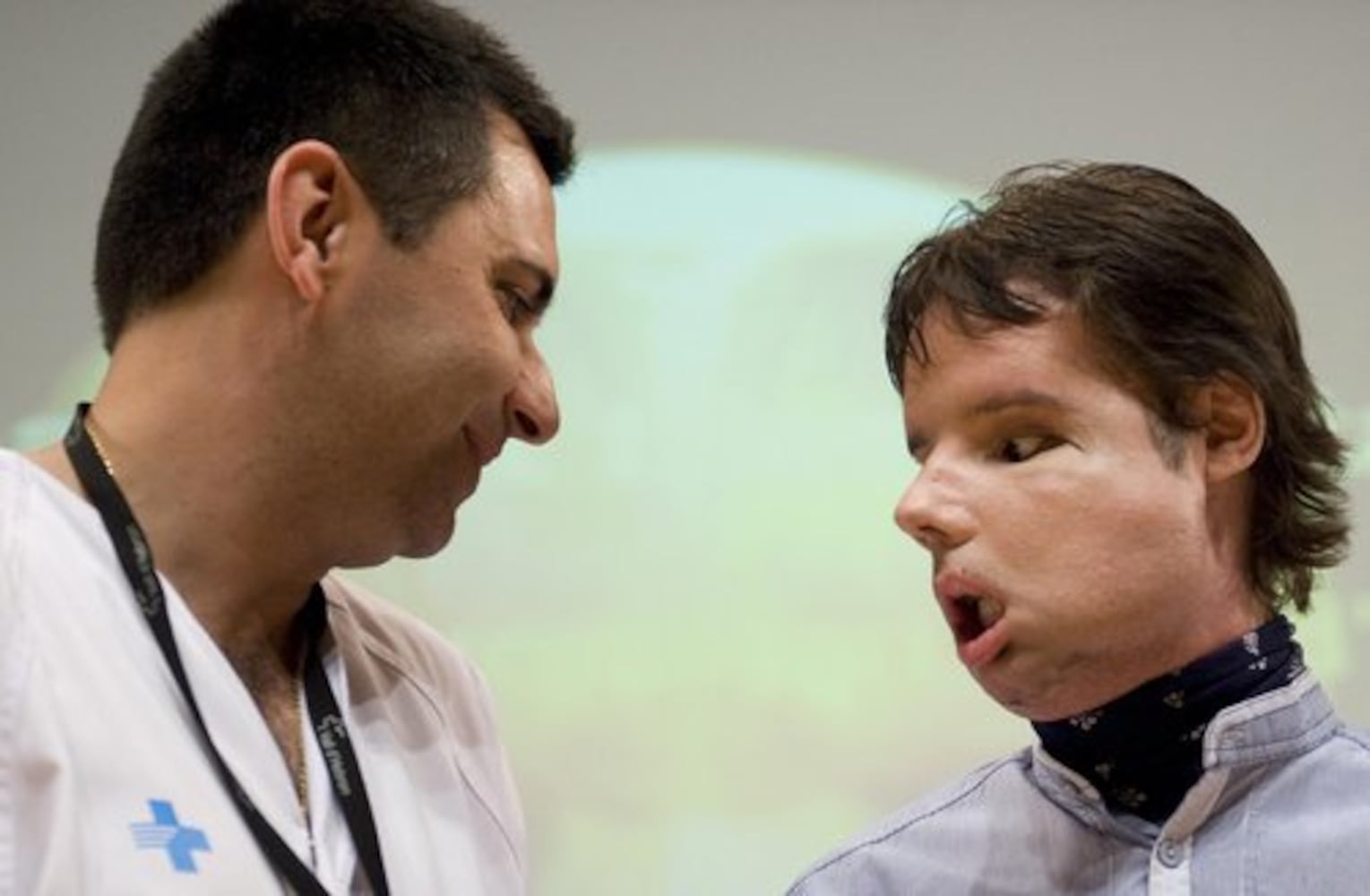 Spain's face transplant success stories