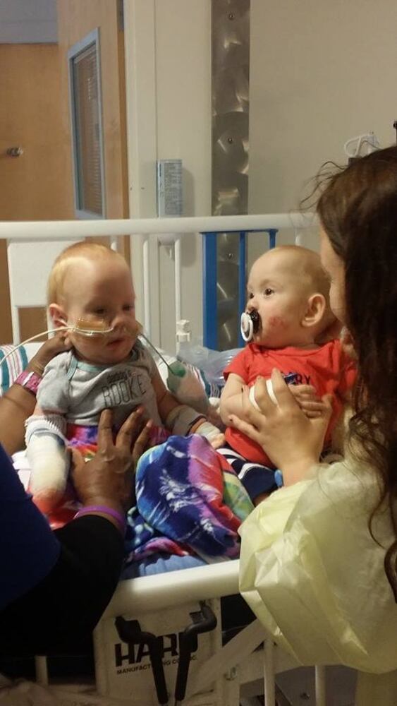 Formerly conjoined twins Carter and Conner