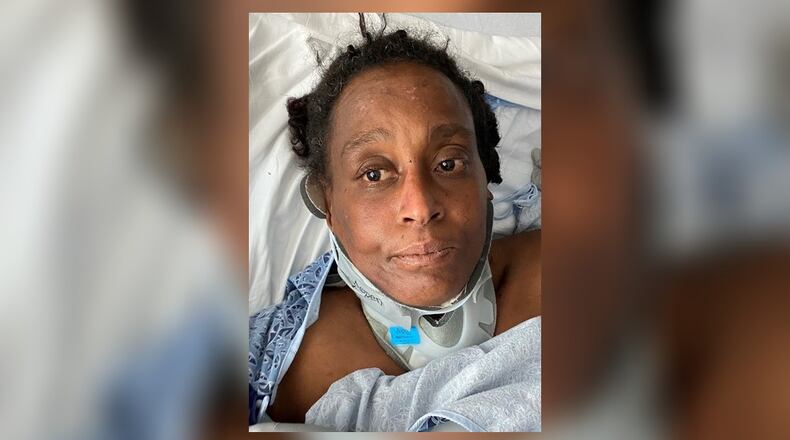 A woman who was struck by a car last month in Midtown was identified Thursday after Grady Memorial Hospital circulated the patient's photo and asked the public for help.