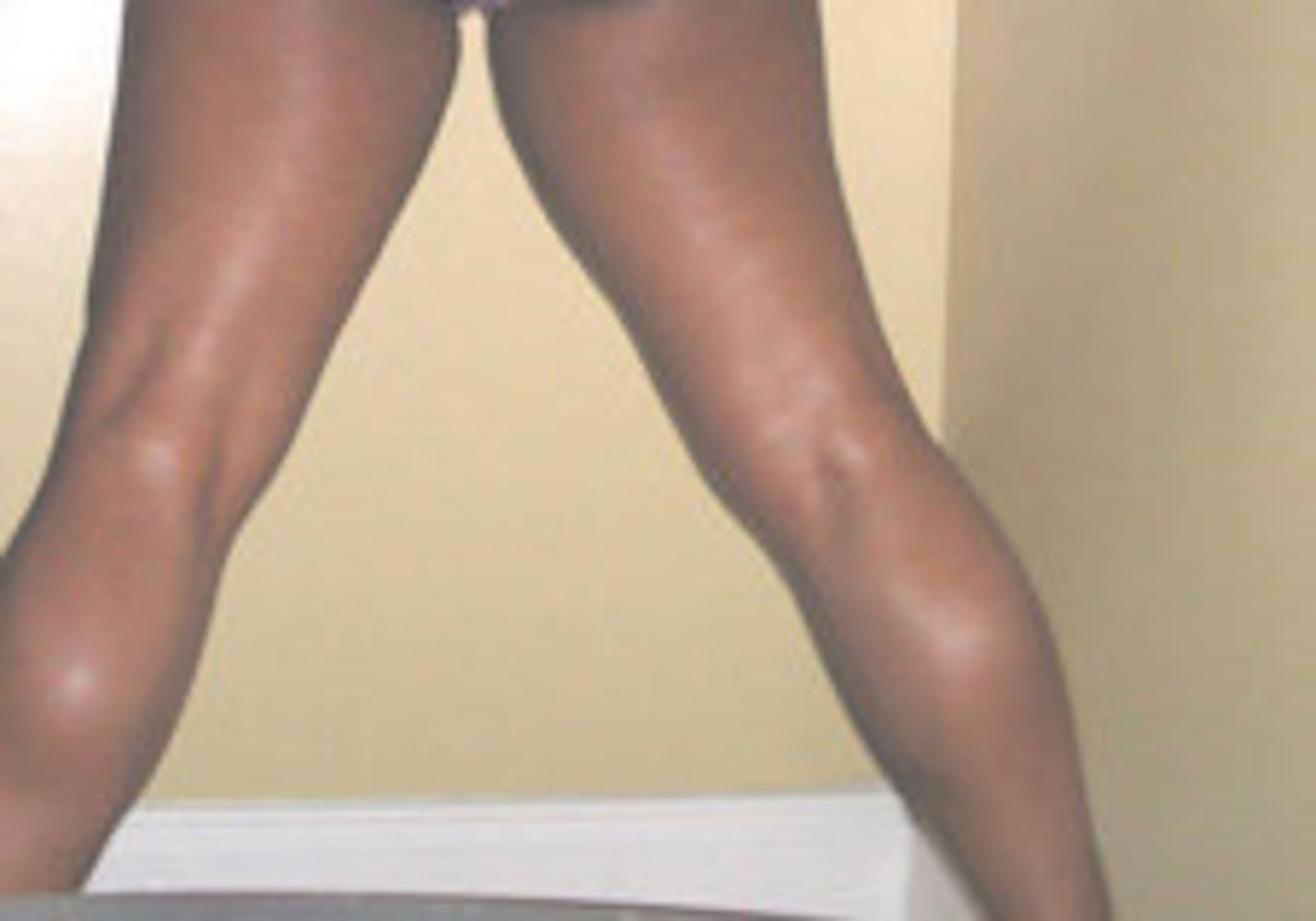 Atlanta's Best Legs Contest - Gallery 4
