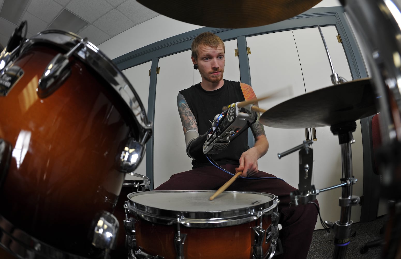 Jason Barnes and the robotic prosthesis
