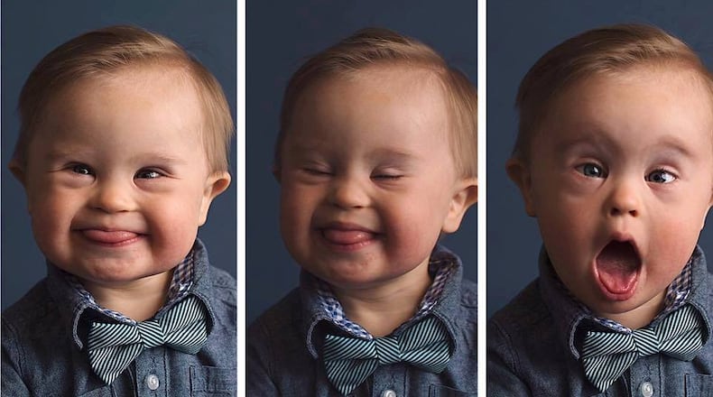 Asher Nash is 16 months old and lives with his parents in Gwinnett County. (Family photo)