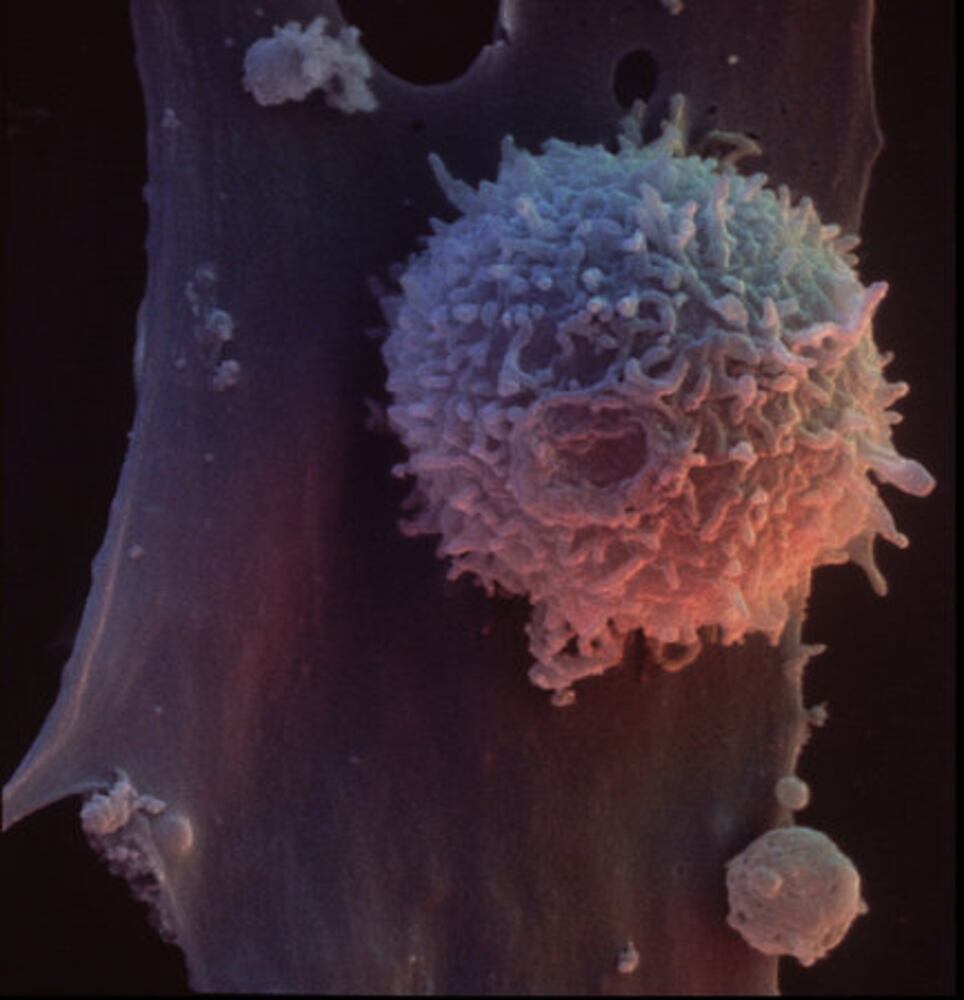 An HIV/AIDS timeline