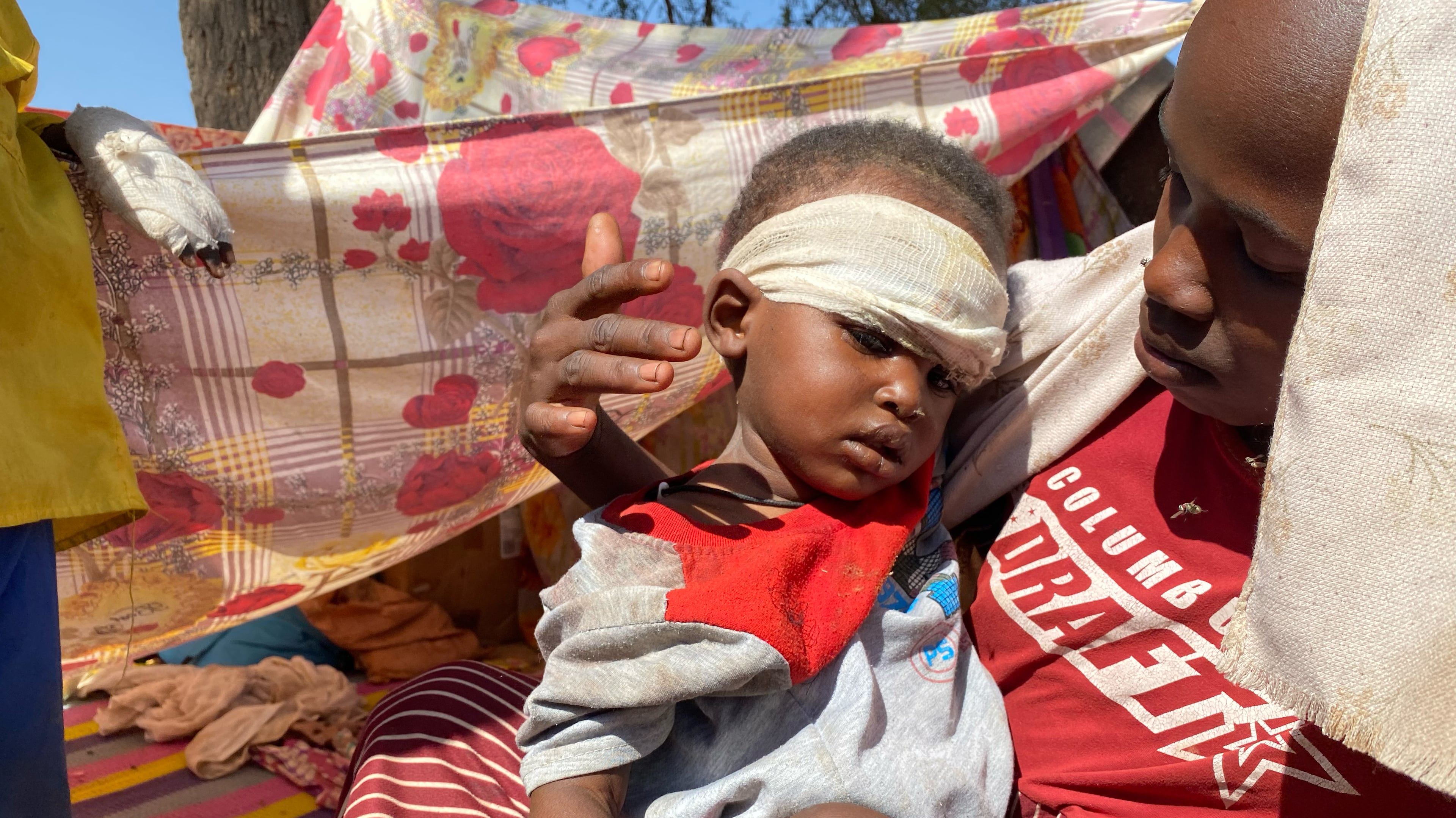 A Sudanese child who fled el-Fasher city with family after Sudan's paramilitary forces killed hundreds of people in the western Darfur region, receives treatment at a camp in Tawila, Sudan, Sunday, Nov. 2, 2025. (AP Photo/Mohammed Abaker)