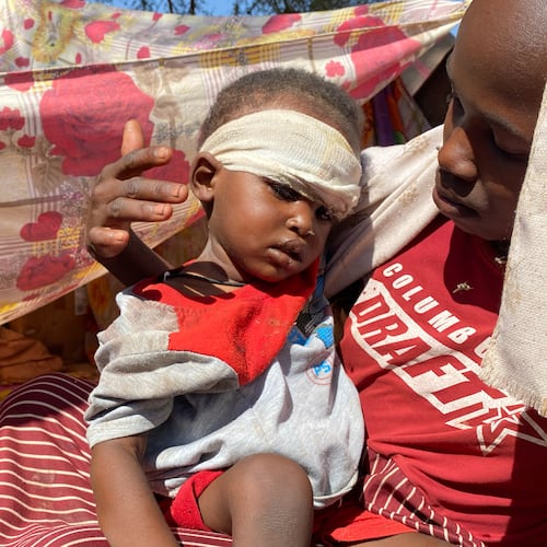 A Sudanese child who fled el-Fasher city with family after Sudan's paramilitary forces killed hundreds of people in the western Darfur region, receives treatment at a camp in Tawila, Sudan, Sunday, Nov. 2, 2025. (AP Photo/Mohammed Abaker)