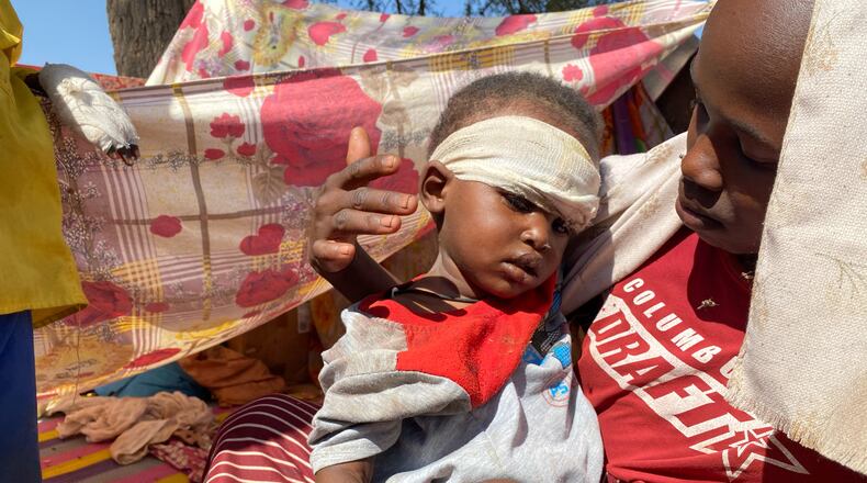 A Sudanese child who fled el-Fasher city with family after Sudan's paramilitary forces killed hundreds of people in the western Darfur region, receives treatment at a camp in Tawila, Sudan, Sunday, Nov. 2, 2025. (AP Photo/Mohammed Abaker)