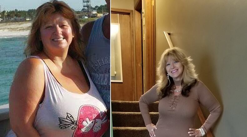In the photo on the left, taken in 2015, Ramona Wood weighed 244 pounds. In the photo on the right, taken this past summer, she weighed 154 pounds. (All photos contributed by Ramona Wood)
