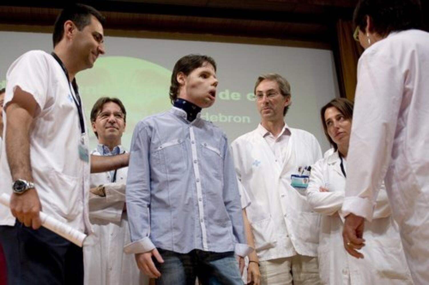 Spain's face transplant success stories