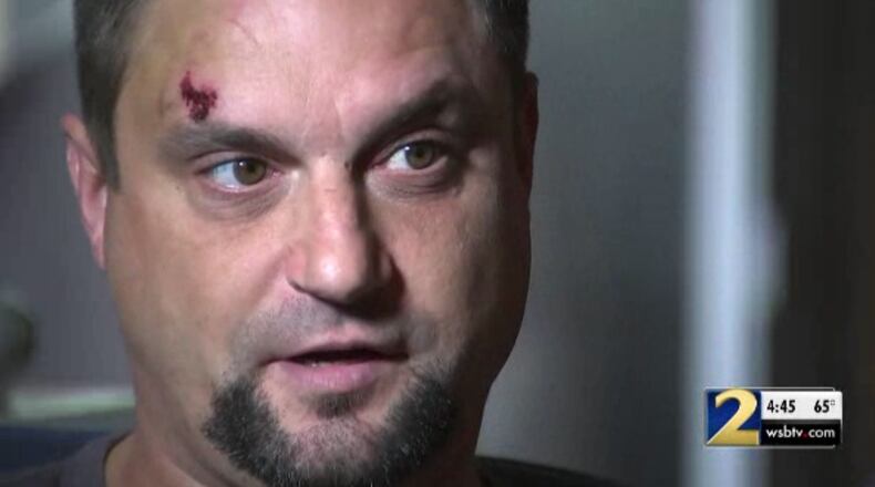 Bo Watson suffered multiple injuries, including a fractured skull and broken leg, when he was beaten by a man at a Roswell apartment complex, police said.