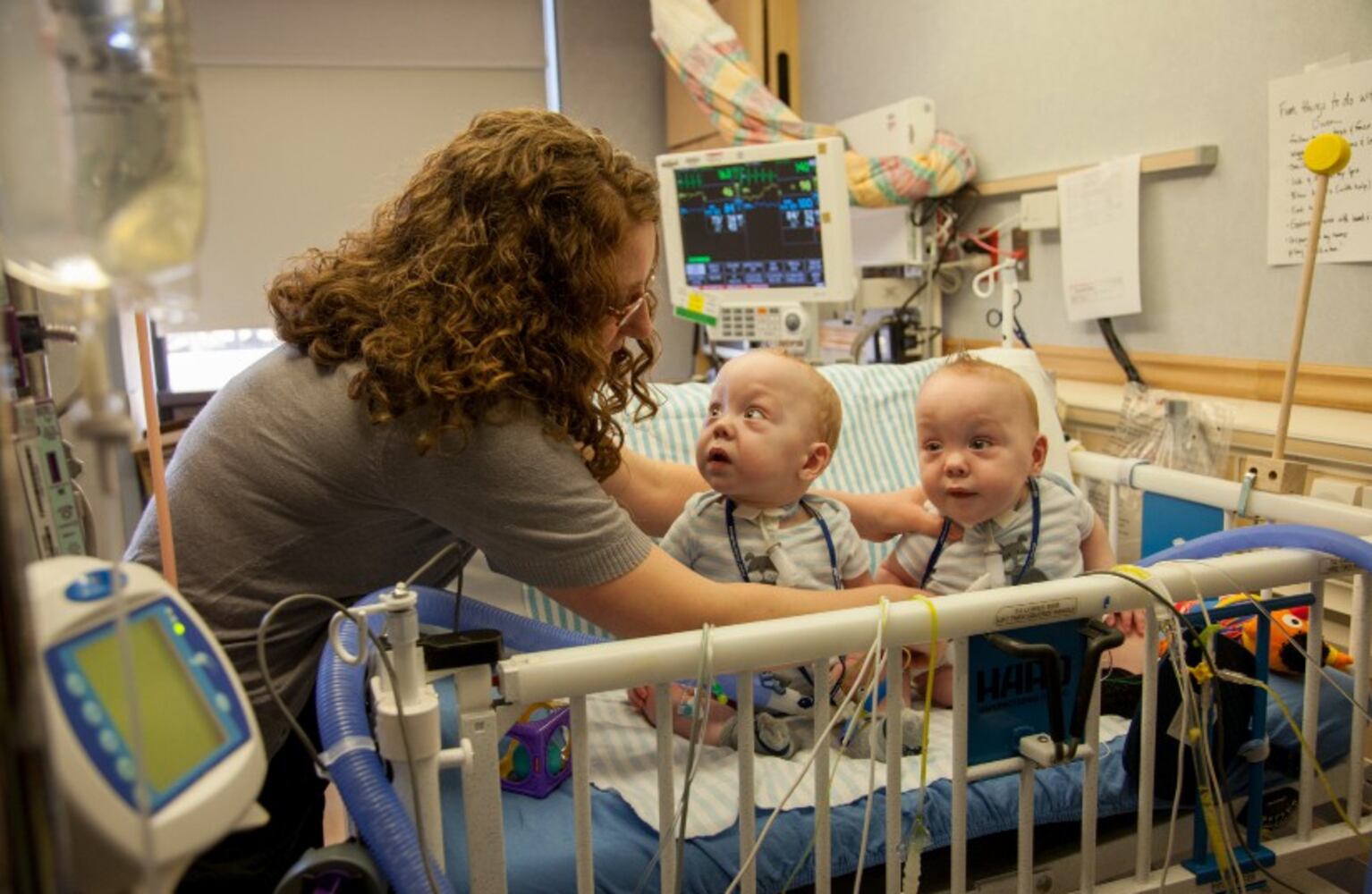 Separated conjoined twins released from Dallas hosptial