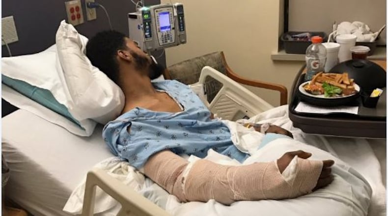 Charles Savoy was struck by a car Jan. 15 in Johns Creek. (Credit: Channel 2 Action News)