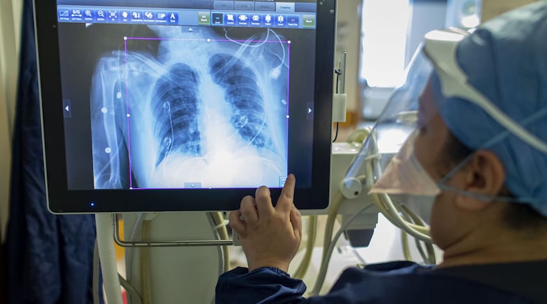Arlene Ramirez, an MRI technologist, reviews a chest X-ray from a COVID-19 patient in the ICU on May 11, 2020, at St. Anthony Hospital in Chicago. (Brian Cassella/Chicago Tribune/TNS)
