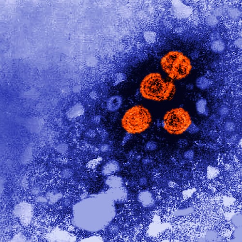 FILE - This 1981 electron microscope image made available by the U.S. Centers for Disease Control and Prevention shows hepatitis B virus particles, indicated in orange. (Dr. Erskine Palmer/CDC via AP, File)