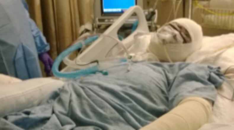 Georgia woman Khaliah Shaw is hospitalized in 2014 after a medication error caused her skin to literally melt off her body. Shaw says she wants to make people aware of how dangerous some drugs can be.