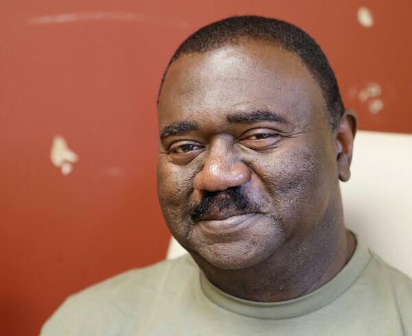 Willie Blackwell, a former NFL player, hasn’t given up hope of getting a new kidney. “When you take care of people, God will take care of you,” he said. BOB ANDRES / ROBERT.ANDRES@AJC.COM