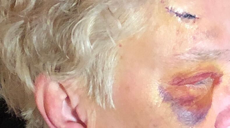 A woman suffered severe bruises during a carjacking at a car wash in Athens.