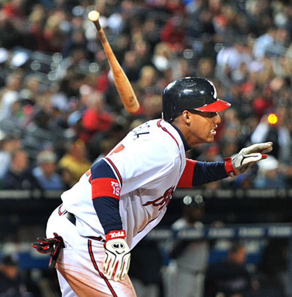 Feel the pain: Infamous Braves injuries