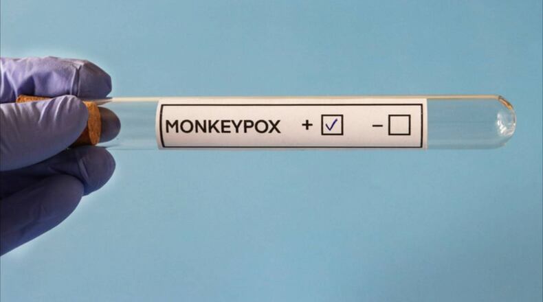 US Monkeypox Outbreak Is Worse Than CDC’s Initial Report