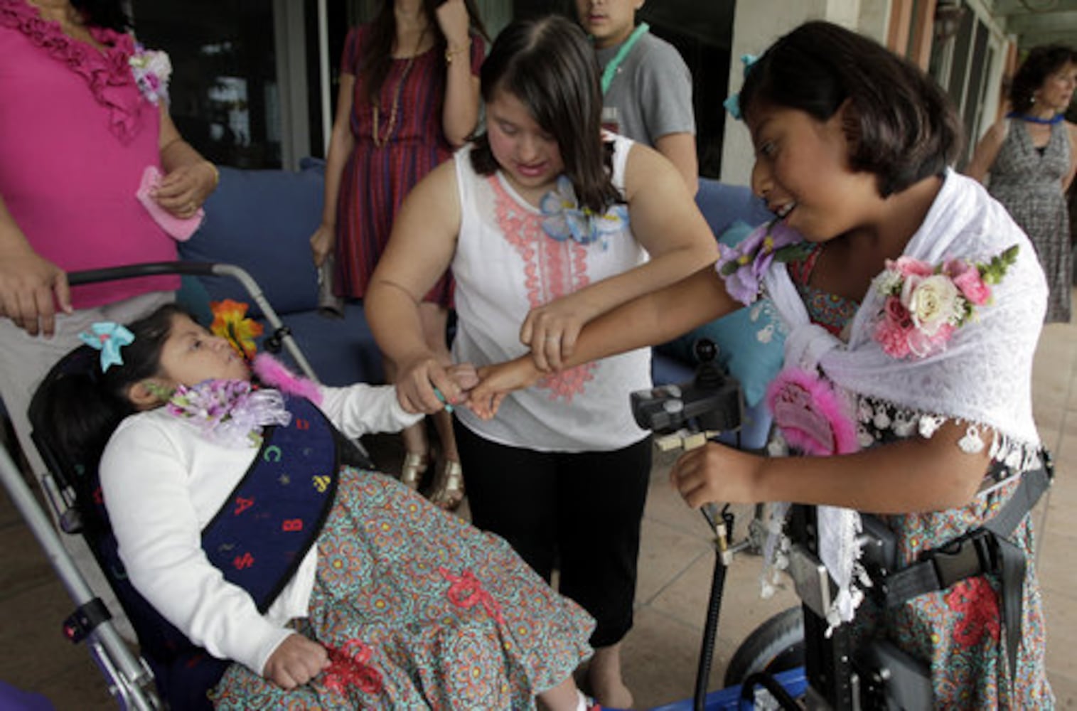 Guatemalan twins, formerly conjoined, turn 10