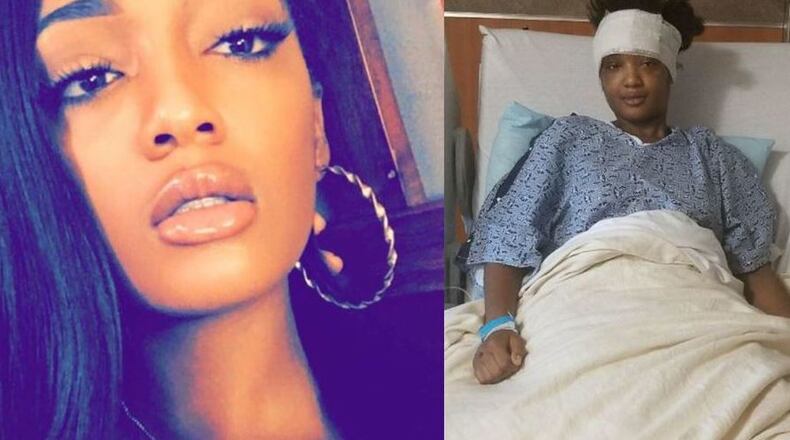 Angelica Green, 20, was crossing Old National Highway with her boyfriend when a car hit her and the driver took off Oct. 11.