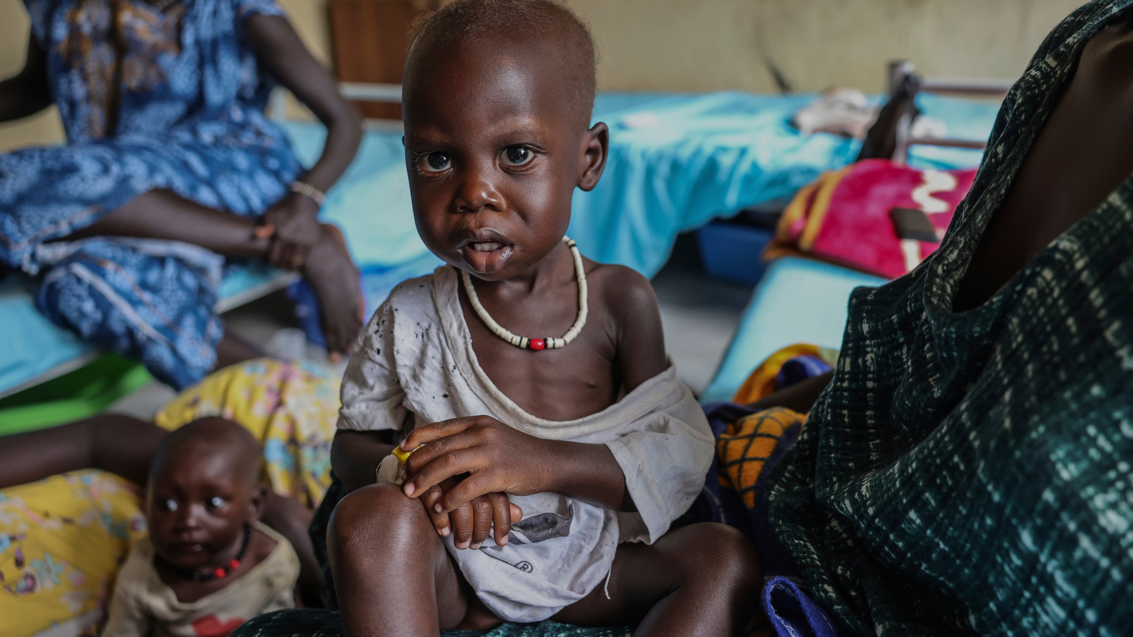 Adut Duor, 14 months old, sits on his mother's lap in the malnutrition ward of Bunj Hospital in Maban, South Sudan, Monday, Aug. 18, 2025. (AP Photo/Caitlin Kelly)
