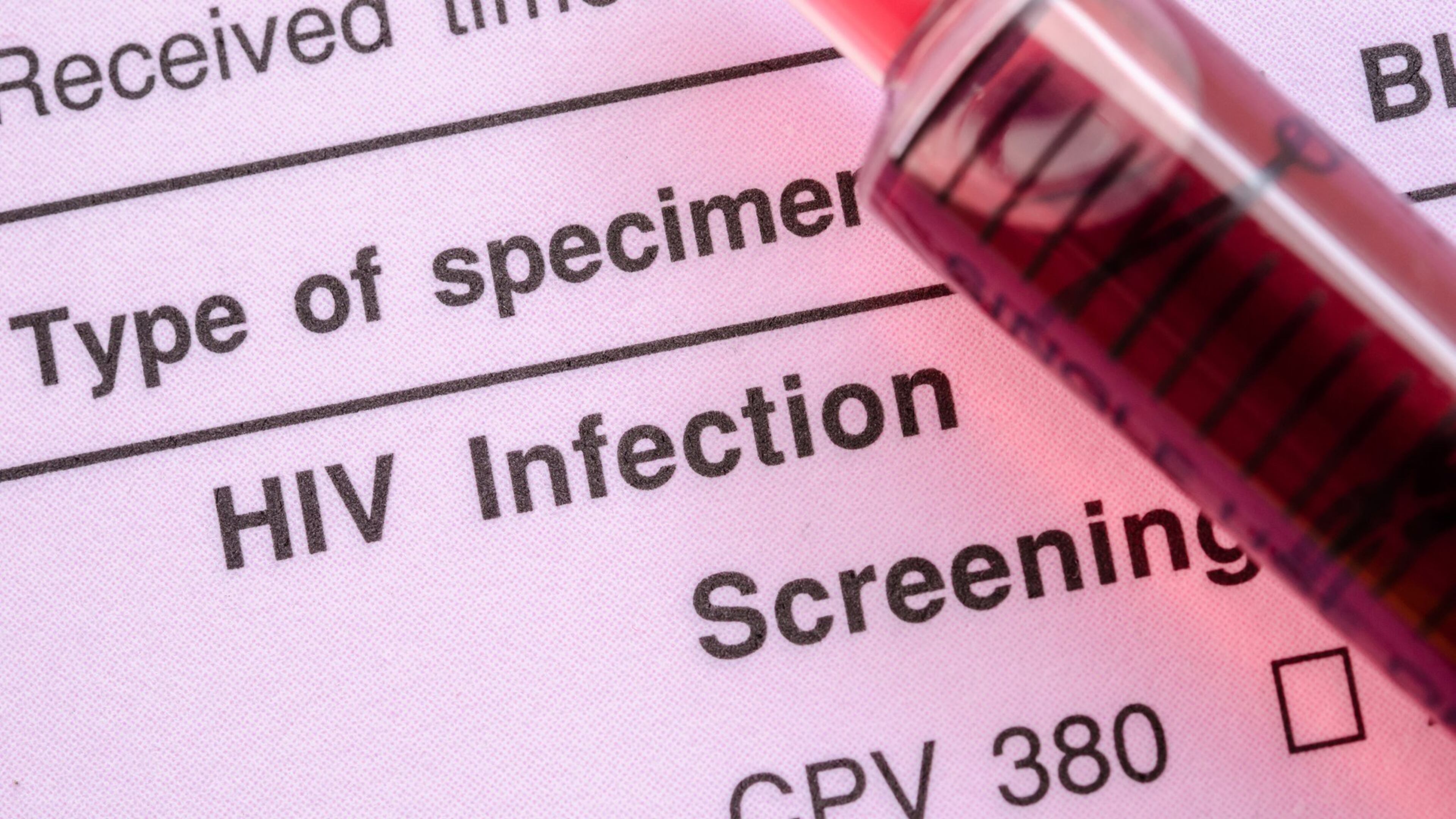 Reinstated workers of CDC's Division of HIV Prevention are being tasked with dismantling their own departments, according to a 20-year veteran of the CDC. (Dreamstime/TNS)