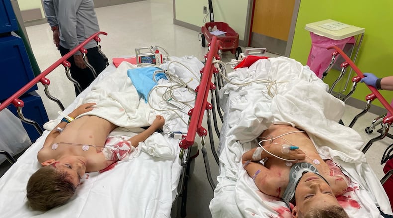 Foster Godfrey, 6, looks at his older brother Rett, 8, as they are getting ready for surgery following a mauling by two Rottweilers in Alpharetta this month. (Credit: Photo courtesy of Scott Godfrey)