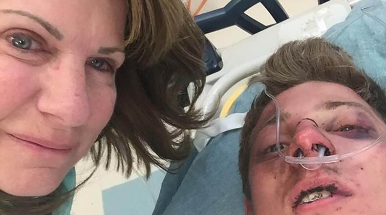 The mother of James Hubert, the missing Georgia Tech student found alive Monday morning, posted this photo of her son on her public Facebook page. “He’s awake,” she wrote. “Running lots of tests. Pray for speedy recovery.” (Credit: Facebook)