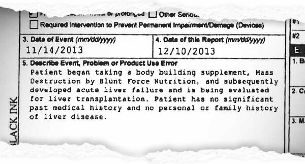 Adverse event reports filed with the FDA.
