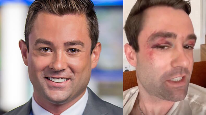 Adam Klotz, a Fox News meteorologist who previously worked at Atlanta's Fox 5, was attacked by a group of teens in a New York City subway over the weekend. FOX 5/INSTAGRAM