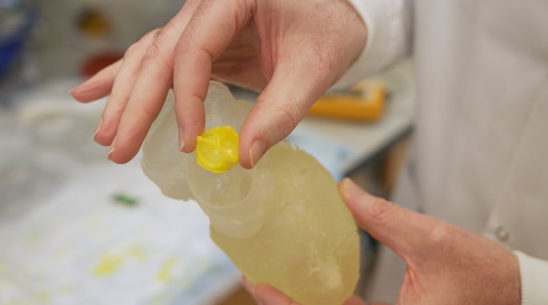 3D-printed heart valve designed to absorb into the body permanently