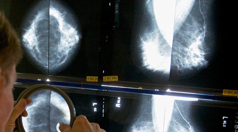 FILE - A radiologist uses a magnifying glass to examine mammograms for breast cancer in Los Angeles, May 6, 2010. (AP Photo/Damian Dovarganes, File)