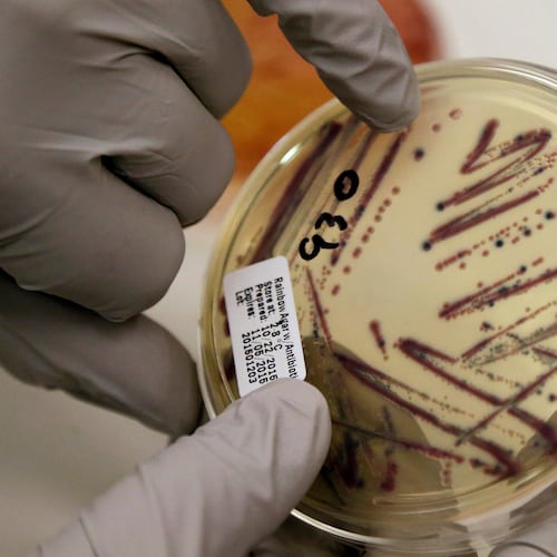 FILE - A microbiologist points out an isolated E. coli growth on an agar plate at the Washington State Department of Health, Nov. 3, 2015, in Shoreline, Wash. (AP Photo/Elaine Thompson, File)