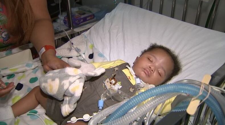 Amir was born with flimsy airways and two holes in his heart.