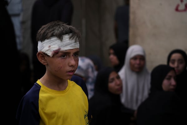 Ali Al-Aimawi attends the funeral of his relatives, who were killed in an Israeli bombardment of Al-Zawaideh, a strike in which he was also injured, at the morgue of Al-Aqsa Hospital in Deir al-Balah, Gaza Strip, on Tuesday, July 1, 2025. (AP Photo/Abdel Kareem Hana)