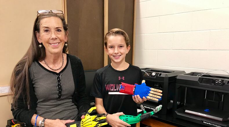 The Walker School student Anderson Carey, 12, and his science teacher, Dr. Holly Martin, created a 3D printed prosthetic arm for Cornel Crismaru, a Romanian man who lost a leg, hand and forearm to a bacterial infection.