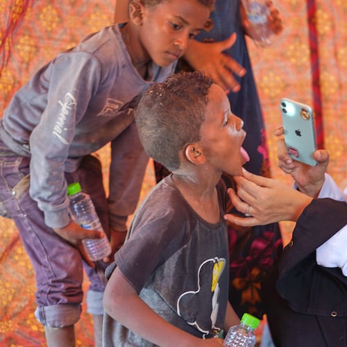 A doctor examines a displaced child at Al-Firdaws camp in Ras Imran, just outside Aden, Yemen, Monday, Sept. 14, 2026. (AP Photo/Abdulnasser Alseddik)