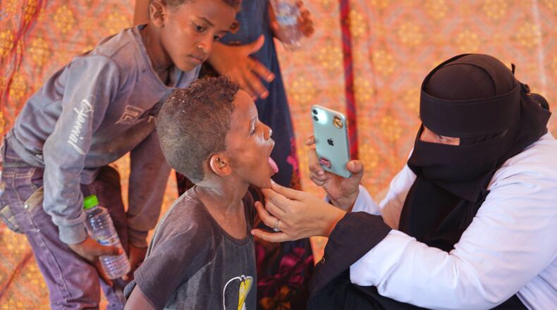 A doctor examines a displaced child at Al-Firdaws camp in Ras Imran, just outside Aden, Yemen, Monday, Sept. 14, 2026. (AP Photo/Abdulnasser Alseddik)